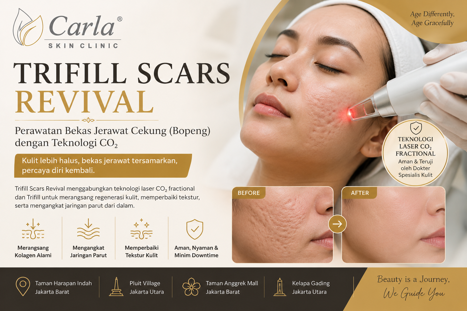 Trifill Scars Revival: Perawatan Bekas Jerawat Cekung (Bopeng) dengan Teknologi CO₂