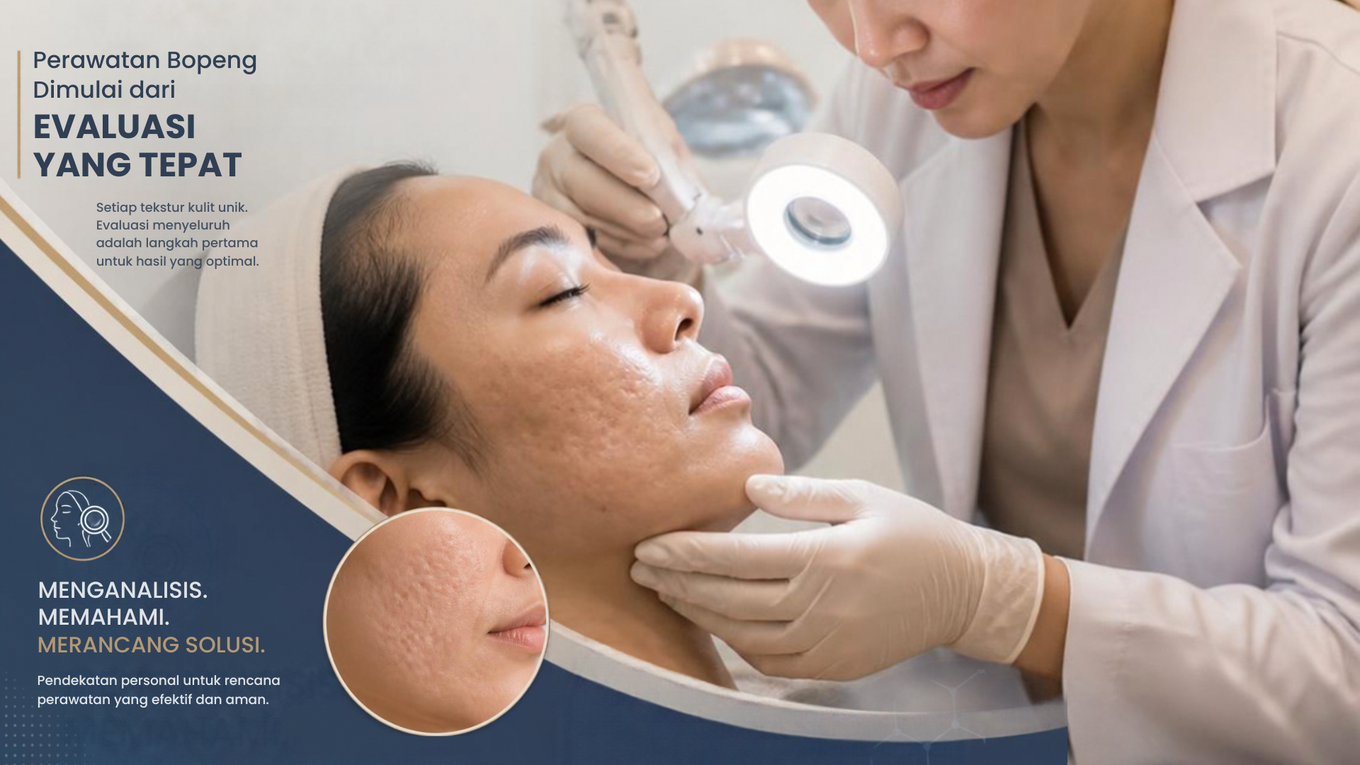 Apa Saja Treatment Bopeng di Carla Skin Clinic? Kenali Pilihannya