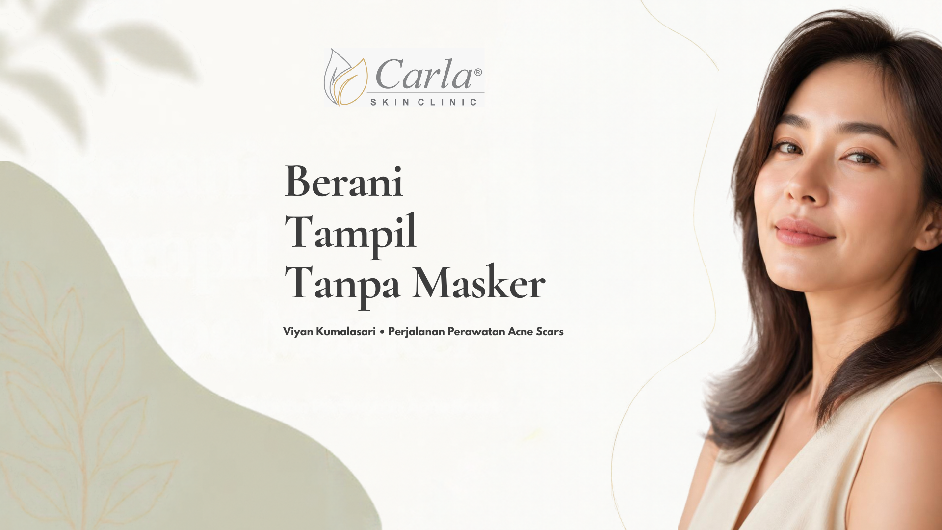 Empat Tahun Menyembunyikan Wajah, Viyan Kini Berani Tampil Tanpa Masker