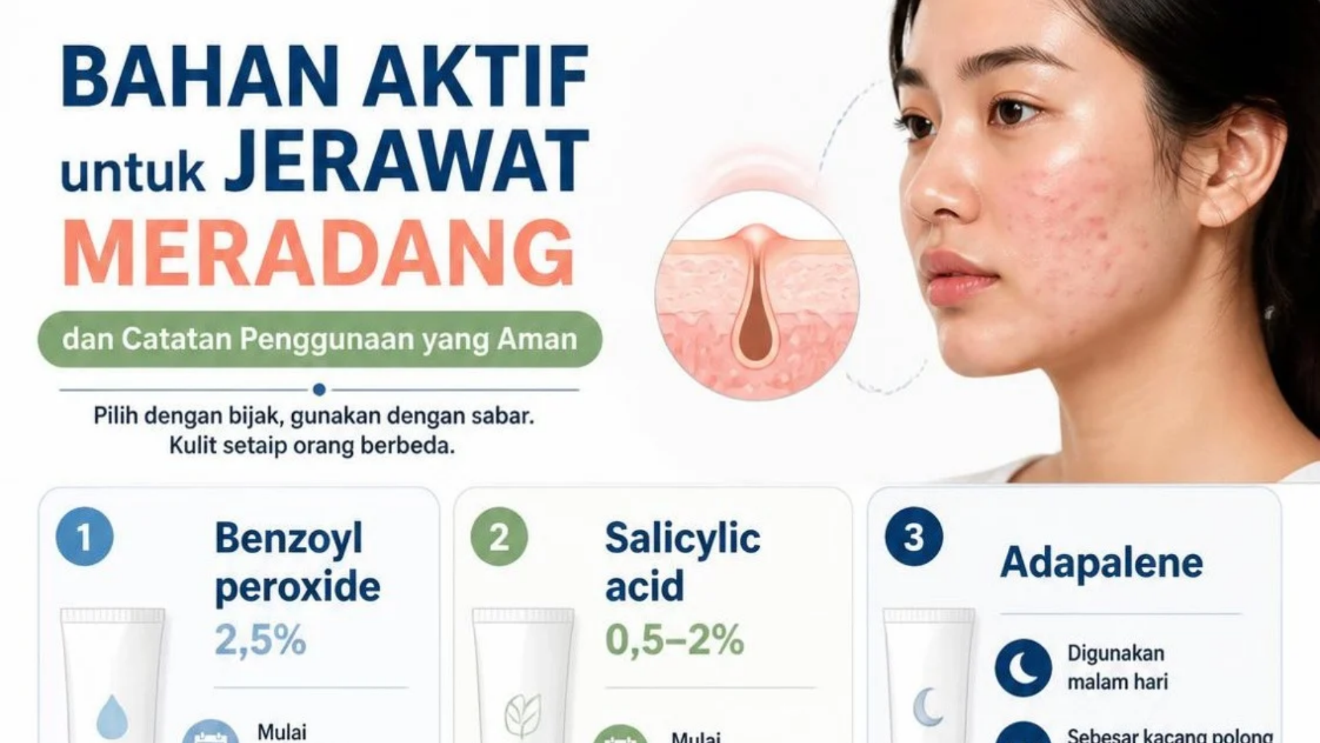 Kenali Cara Cegah Bopeng Akibat Jerawat Meradang dan Kandungan Skincare Ampuh