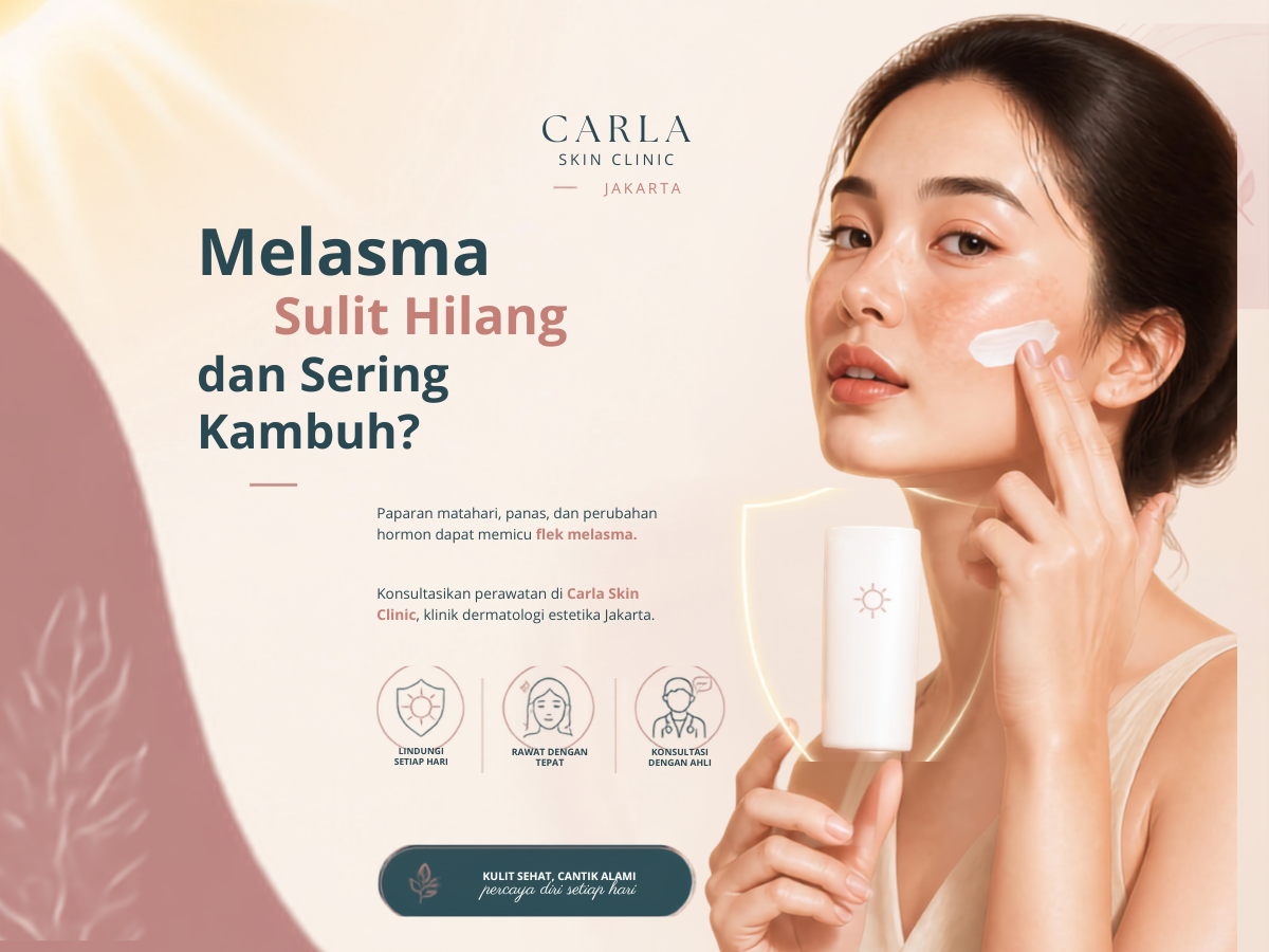 Melasma Sulit Hilang dan Sering Kambuh, Kenali Faktor Pemicunya!