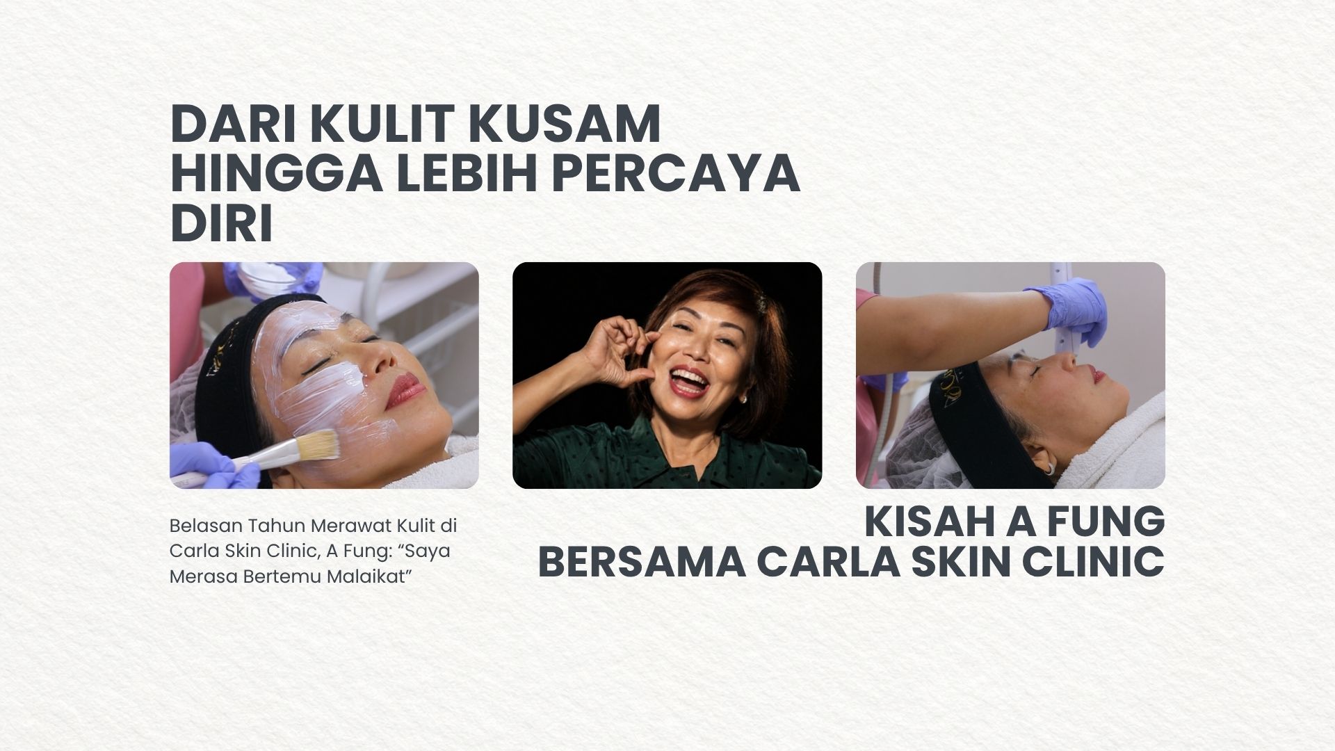 Dari Kulit Kusam hingga Lebih Percaya Diri, Kisah A Fung Bersama Carla Skin Clinic