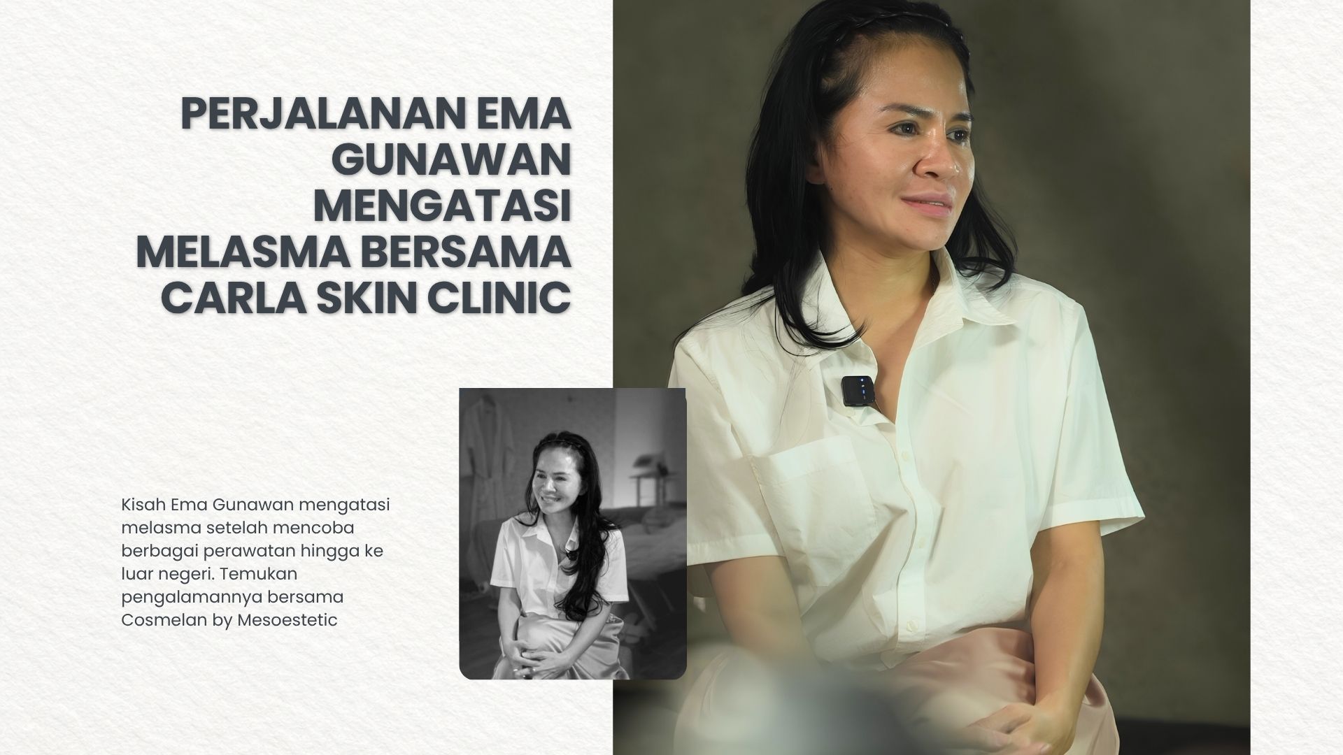 Perjalanan Ema Gunawan Mengatasi Melasma Bersama Carla Skin Clinic