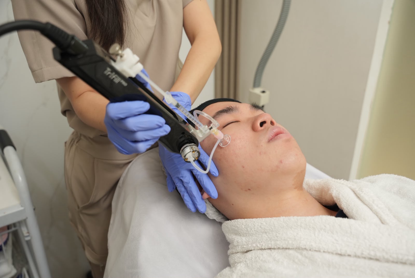 Cara Menghilangkan Bopeng Bekas Jerawat dan PIH: Panduan Lengkap Penyebab, Jenis, dan Treatment yang Efektif