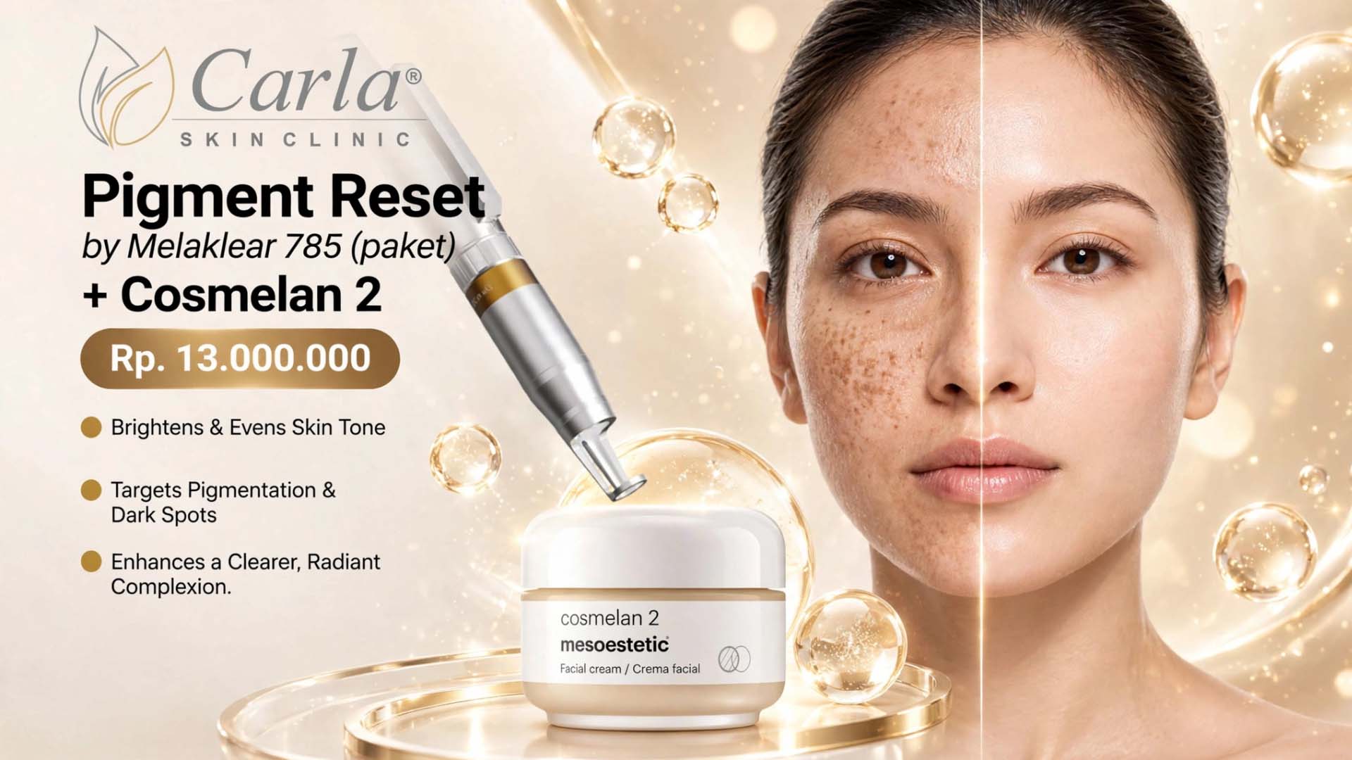 Pigment Reset by MelaKlear 785 X Cosmelan 2