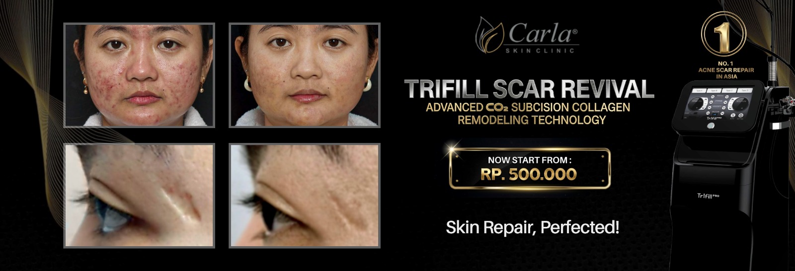 Trifill Scar Revival Promo