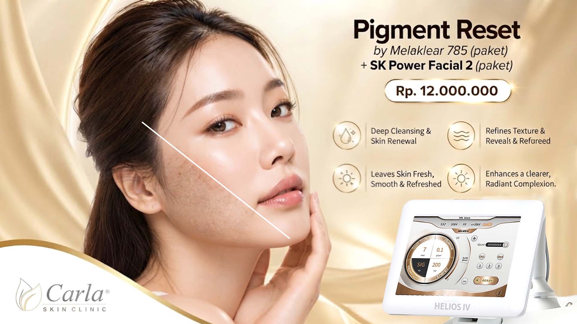 Pigment Reset by MelaKlear 785 × SK Power Facial 2
