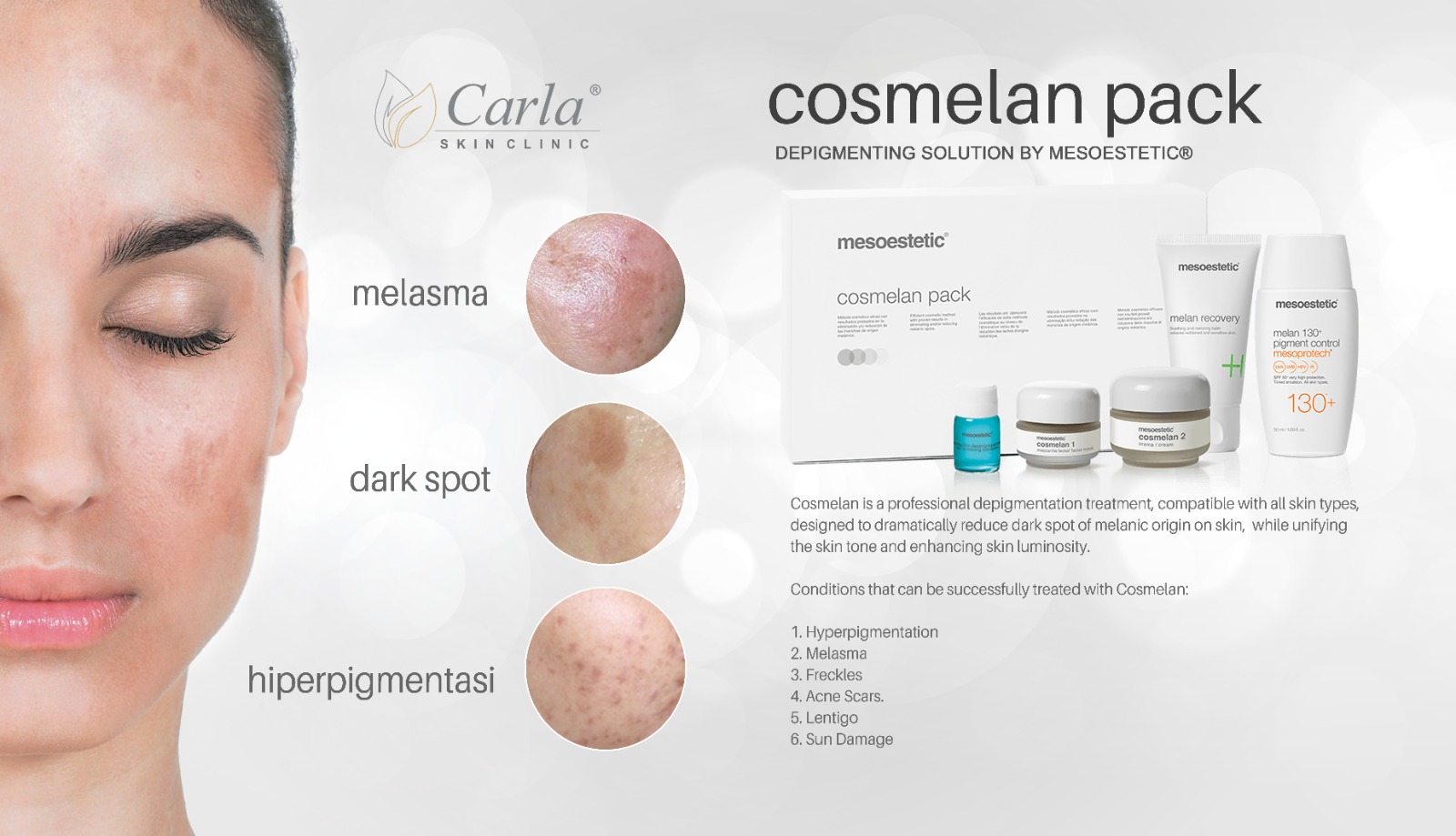 Promo Cosmelan Diskon 15% Carla Skin Clinic Cosmelan untuk membantu menyamarkan tampilan pigmentasi dan meratakan warna kulit. Nikmati diskon 15% semua varian Cosmelan di Carla Skin Clinic.