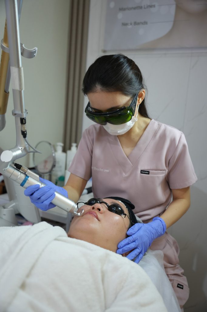 Pico Glass Laser untuk mengatasi melasma dan hiperpigmentasi pada wajah di Carla Skin Clinic dengan teknologi laser modern yang menargetkan melanin secara presisi